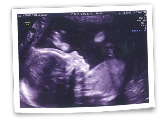 Baby Ultrasound